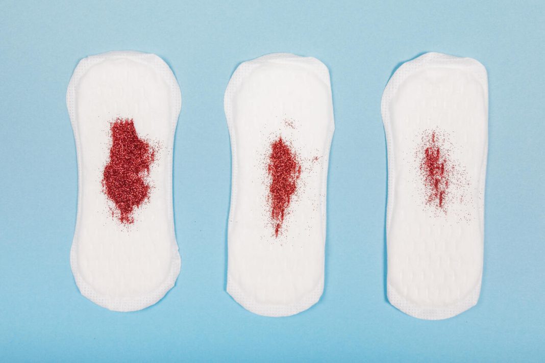 Coágulos na menstruação Normal ou sinal de alerta
