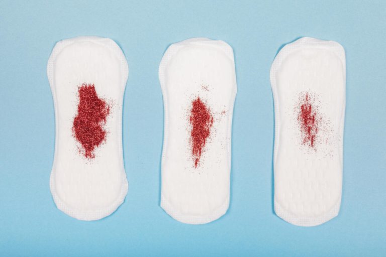 Coágulos na menstruação: o que é normal e quando procurar um médico?